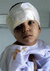 Issam Mostafa, a 3-year-old Lebanese boy